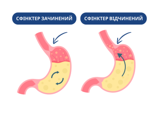 Нижній сфінктер стравоходу (зліва - зачинений, справа - відчинений)